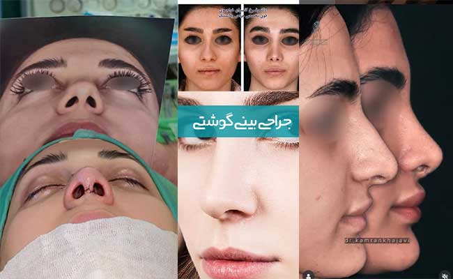 دکتر فرخ کامران خواجوی گرگان
