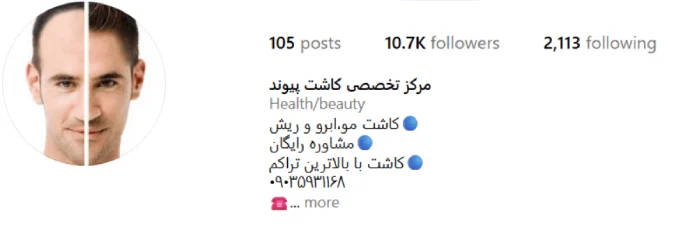 موسسه ترمیم موی پیوند گرگان