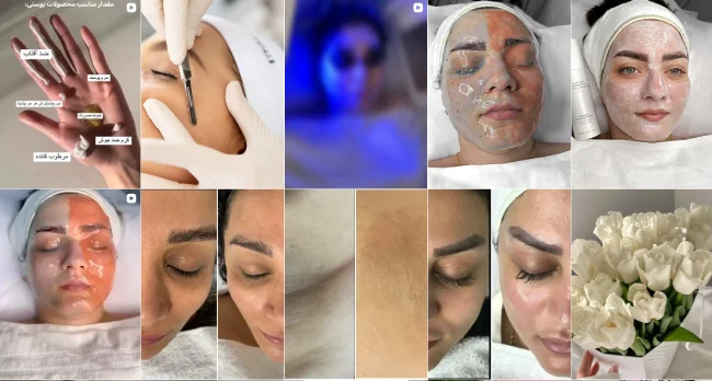 گالری تصاویر پاکسازی و فیشیال پوست هانیه گرگان 4