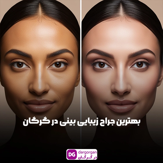 بهترین جراح بینی گرگان به همراه هزینه