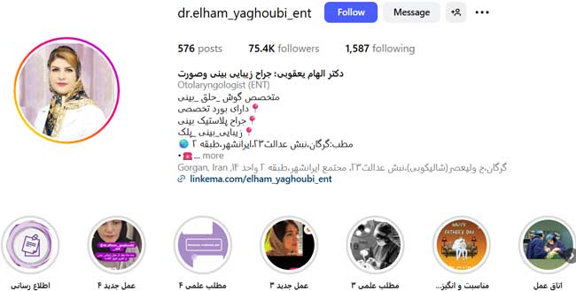 هزینه عمل بینی دکتر الهام یعقوبی بهترین جراح بینی گرگان
