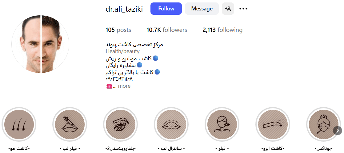 کاشت مو اقساطی گرگان در کینیک پیوند